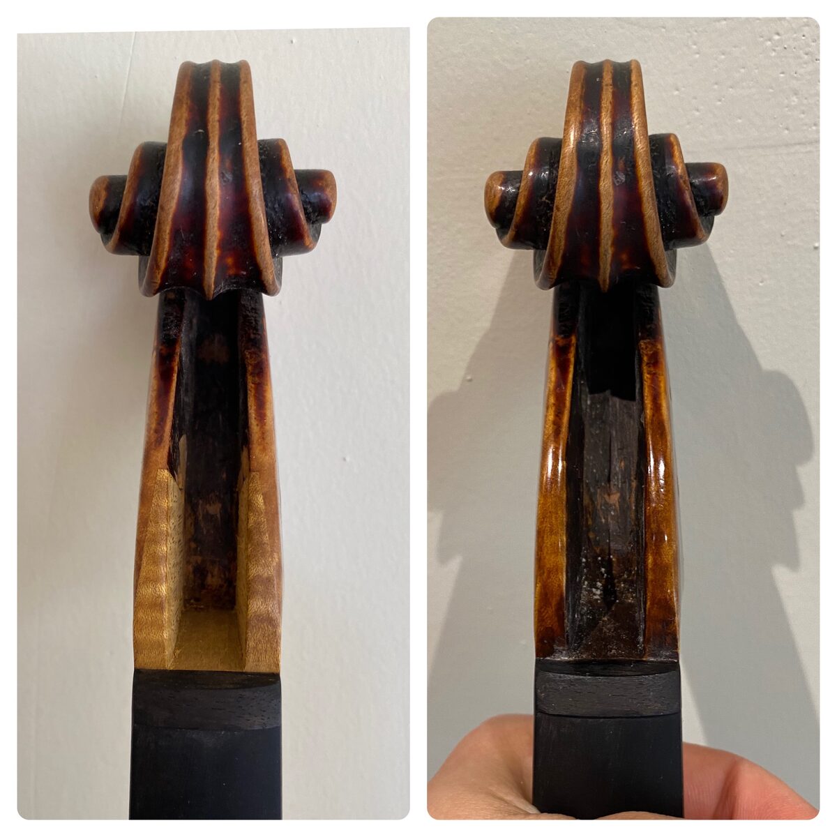 Neck graft, before and after